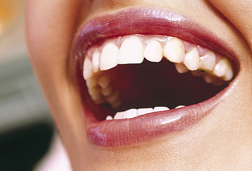 چگونه دندان های سفیدتری داشته باشیم ؟